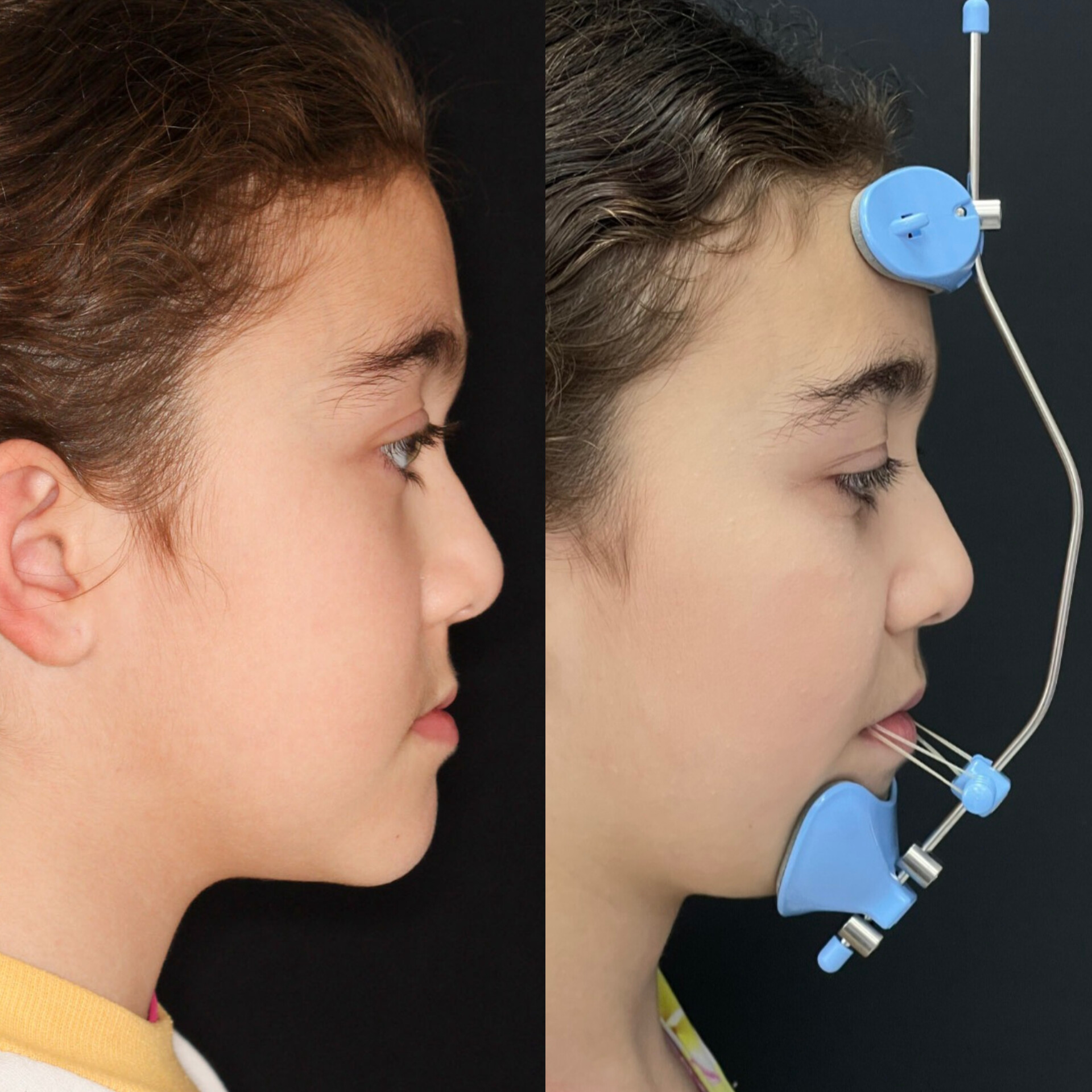 Ortopedia Infantil - Clínica DYVARE